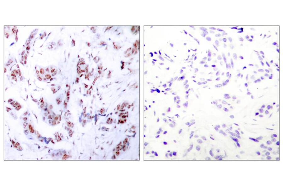 Immunohistochemistry - MEF2a (Ab-312) Antibody from Signalway Antibody (21039) - Antibodies.com