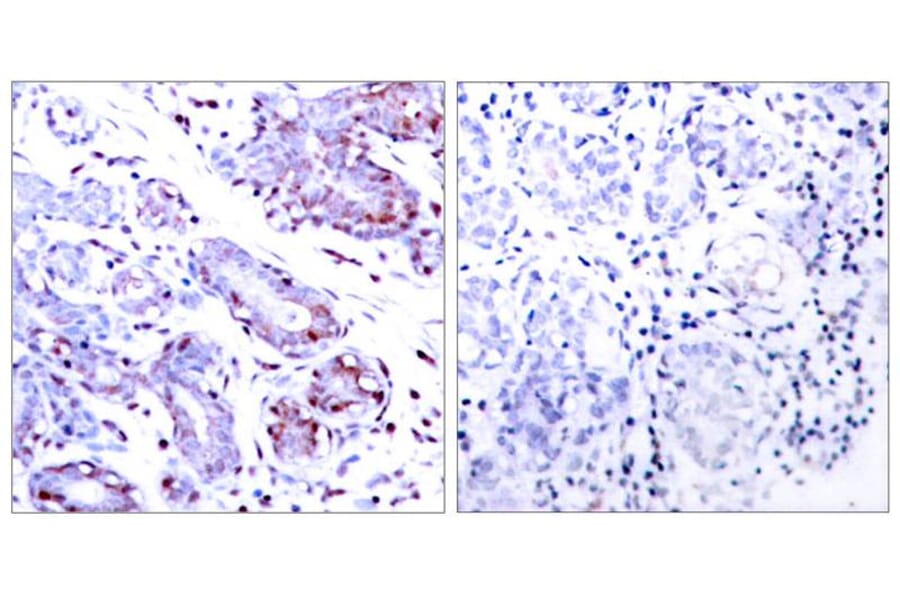Immunohistochemistry - STAT1 (Ab-701) Antibody from Signalway Antibody (21044) - Antibodies.com