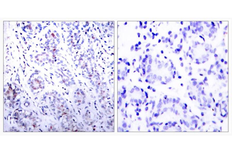 Immunohistochemistry - STAT3 (Ab-727) Antibody from Signalway Antibody (21046) - Antibodies.com