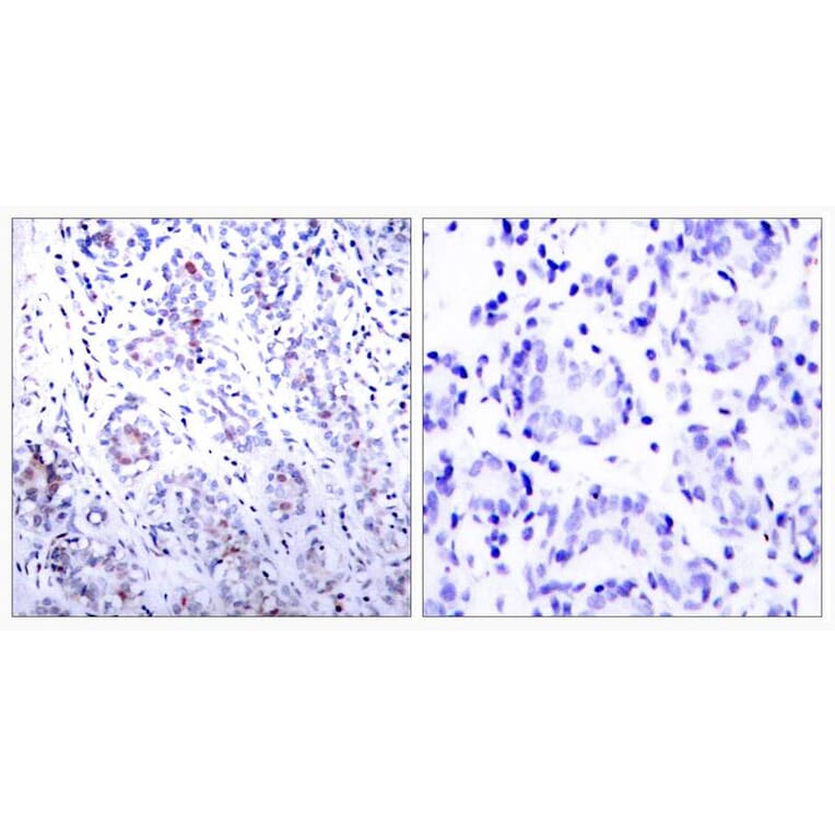 Immunohistochemistry - STAT3 (Ab-727) Antibody from Signalway Antibody (21046) - Antibodies.com