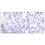Immunohistochemistry - STAT3 (Ab-727) Antibody from Signalway Antibody (21046) - Antibodies.com