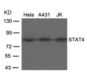Western blot - STAT4 (Ab-693) Antibody from Signalway Antibody (21047) - Antibodies.com