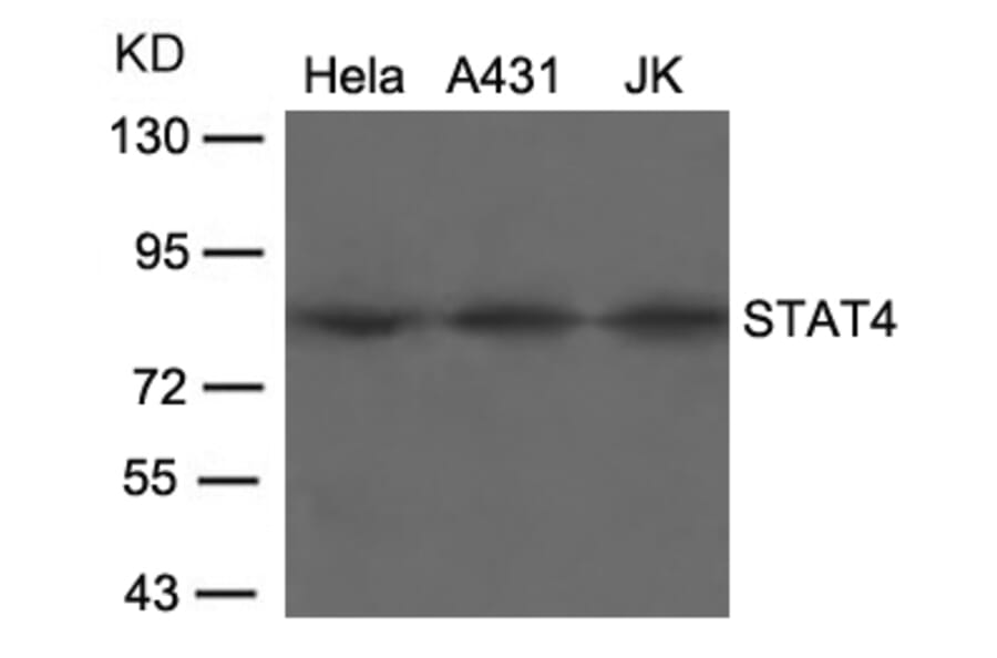 Western blot - STAT4 (Ab-693) Antibody from Signalway Antibody (21047) - Antibodies.com