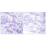 Immunohistochemistry - STAT4 (Ab-693) Antibody from Signalway Antibody (21047) - Antibodies.com