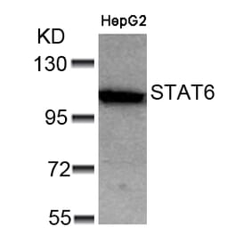 Western blot - STAT6 (Ab-641) Antibody from Signalway Antibody (21050) - Antibodies.com
