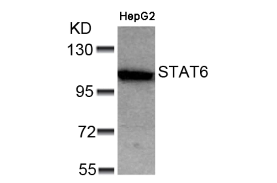 Western blot - STAT6 (Ab-641) Antibody from Signalway Antibody (21050) - Antibodies.com