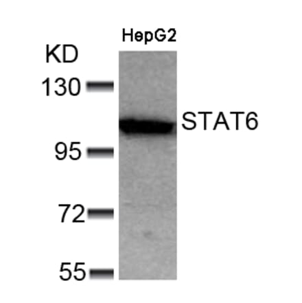 Western blot - STAT6 (Ab-641) Antibody from Signalway Antibody (21050) - Antibodies.com