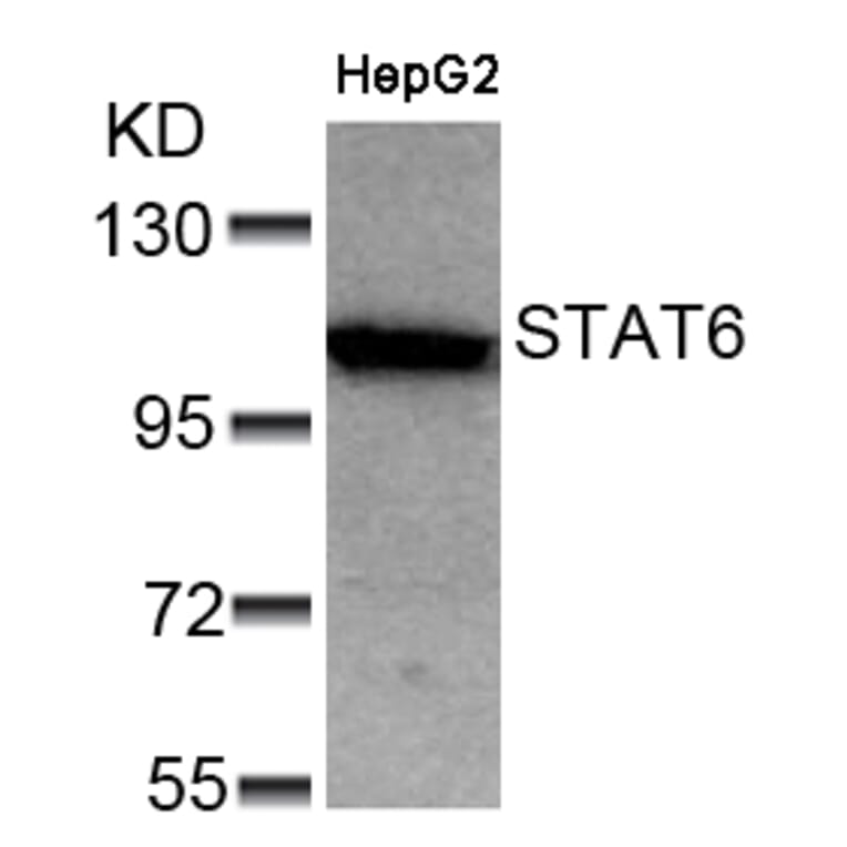 Western blot - STAT6 (Ab-641) Antibody from Signalway Antibody (21050) - Antibodies.com
