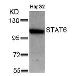 Western blot - STAT6 (Ab-641) Antibody from Signalway Antibody (21050) - Antibodies.com