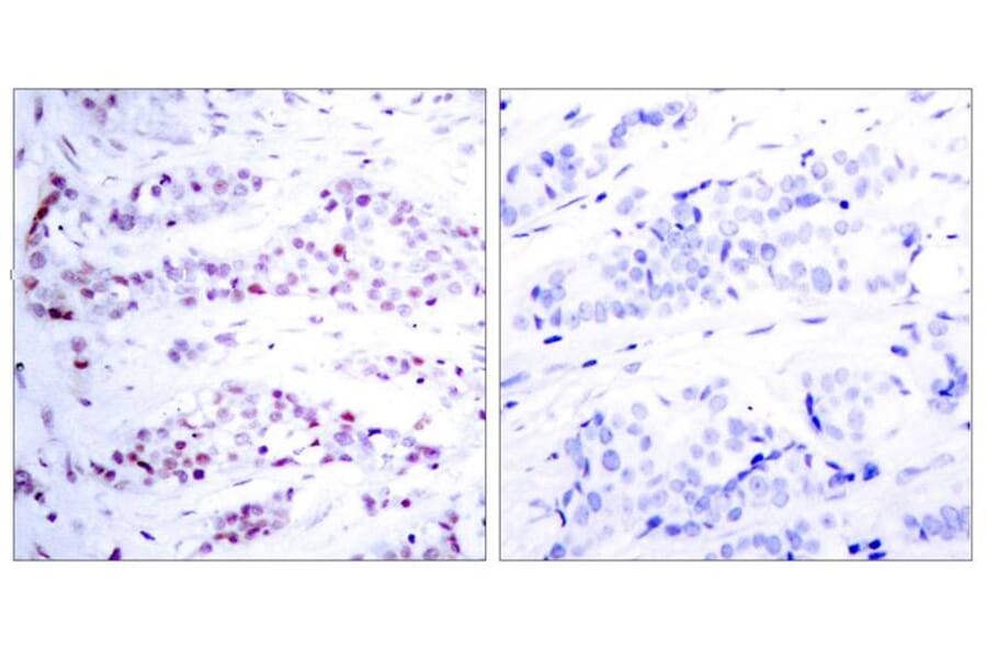 Immunohistochemistry - STAT6 (Ab-641) Antibody from Signalway Antibody (21050) - Antibodies.com