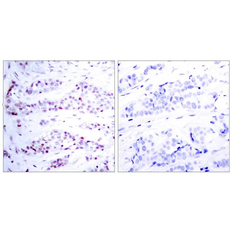 Immunohistochemistry - STAT6 (Ab-641) Antibody from Signalway Antibody (21050) - Antibodies.com