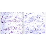 Immunohistochemistry - STAT6 (Ab-641) Antibody from Signalway Antibody (21050) - Antibodies.com