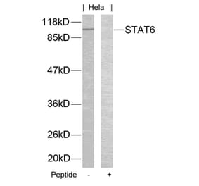 Western blot - STAT6 (Ab-645) Antibody from Signalway Antibody (21051) - Antibodies.com