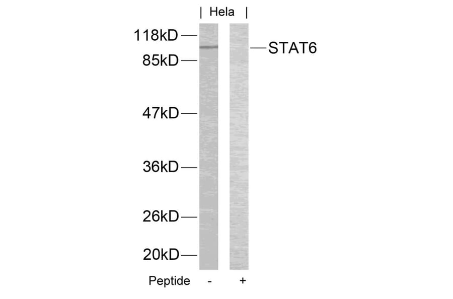 Western blot - STAT6 (Ab-645) Antibody from Signalway Antibody (21051) - Antibodies.com