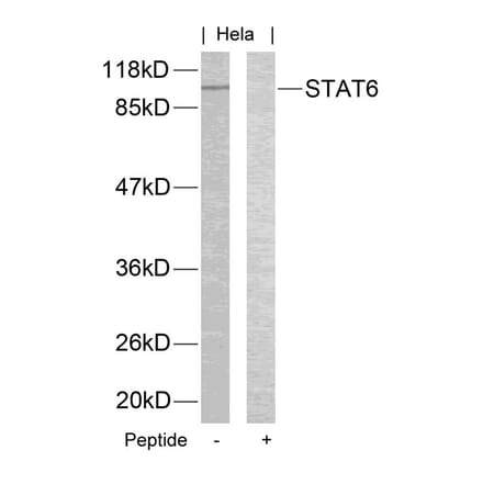 Western blot - STAT6 (Ab-645) Antibody from Signalway Antibody (21051) - Antibodies.com