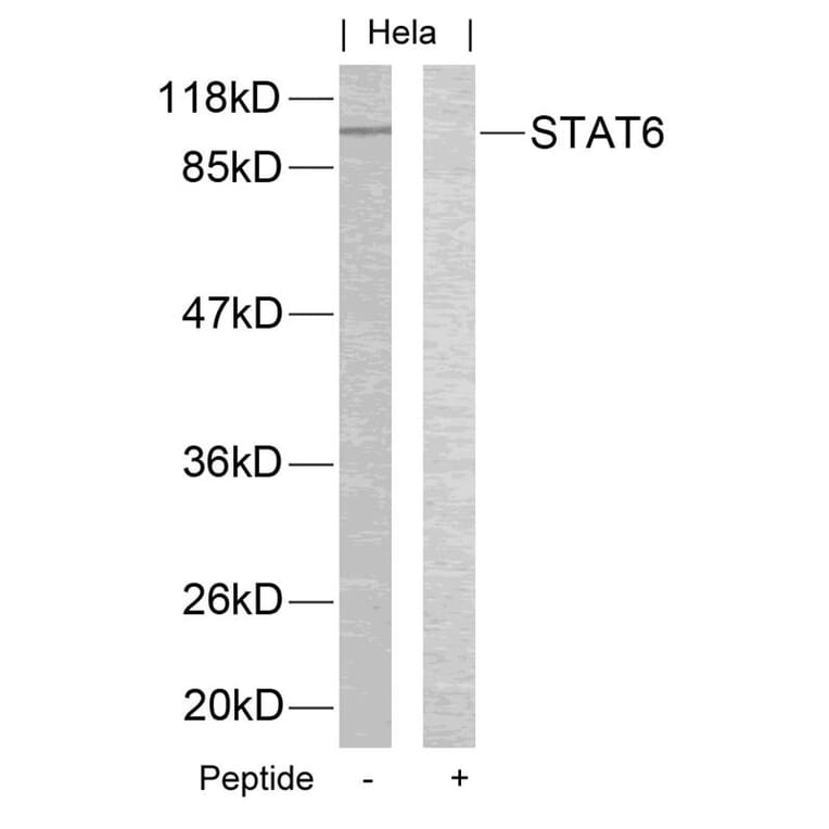 Western blot - STAT6 (Ab-645) Antibody from Signalway Antibody (21051) - Antibodies.com