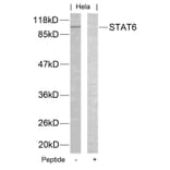Western blot - STAT6 (Ab-645) Antibody from Signalway Antibody (21051) - Antibodies.com