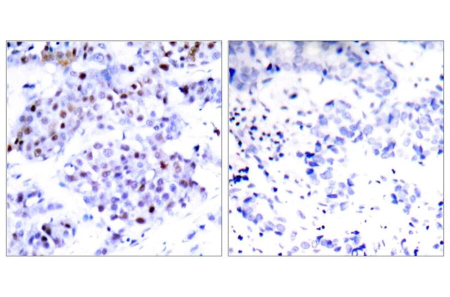 Immunohistochemistry - STAT6 (Ab-645) Antibody from Signalway Antibody (21051) - Antibodies.com