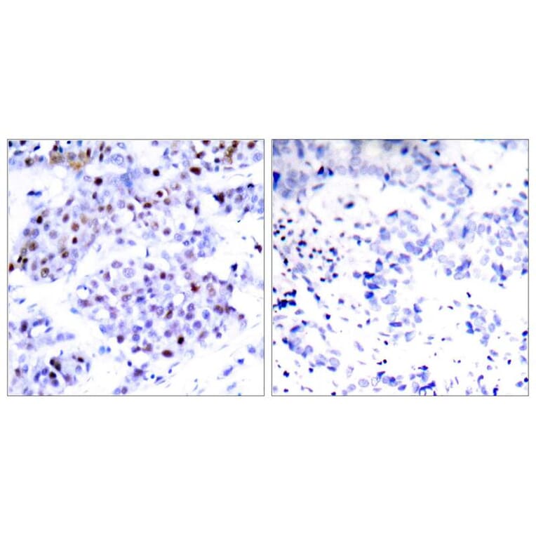 Immunohistochemistry - STAT6 (Ab-645) Antibody from Signalway Antibody (21051) - Antibodies.com