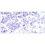 Immunohistochemistry - STAT6 (Ab-645) Antibody from Signalway Antibody (21051) - Antibodies.com