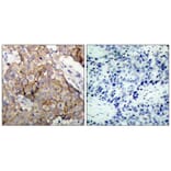 Immunohistochemistry - EGFR (Ab-1092) Antibody from Signalway Antibody (21074) - Antibodies.com