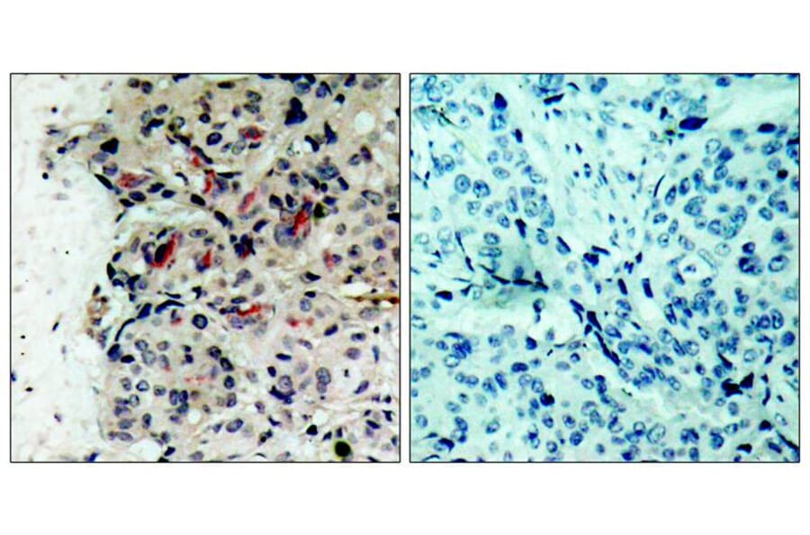 Immunohistochemistry - JAK1 (Ab-1022) Antibody from Signalway Antibody (21119) - Antibodies.com