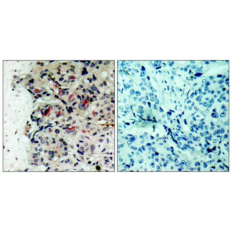 Immunohistochemistry - JAK1 (Ab-1022) Antibody from Signalway Antibody (21119) - Antibodies.com