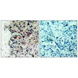 Immunohistochemistry - JAK1 (Ab-1022) Antibody from Signalway Antibody (21119) - Antibodies.com