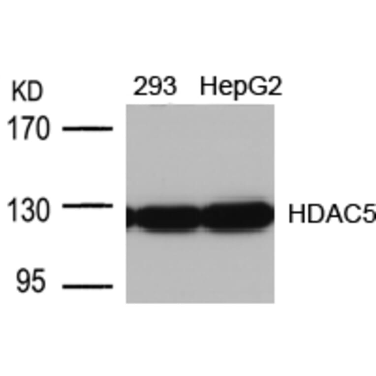 Western blot - HDAC5 (Ab-498) Antibody from Signalway Antibody (21142) - Antibodies.com