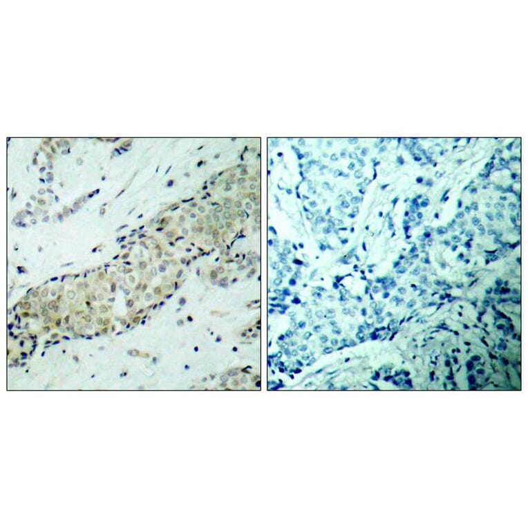 Immunohistochemistry - HDAC5 (Ab-498) Antibody from Signalway Antibody (21142) - Antibodies.com