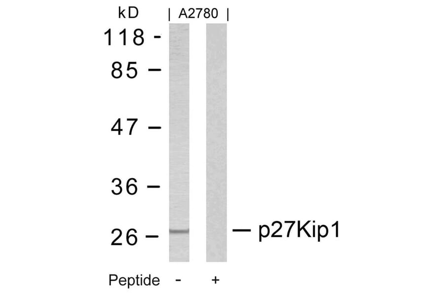 Western blot - p27Kip1 (Ab-10) Antibody from Signalway Antibody (21150) - Antibodies.com