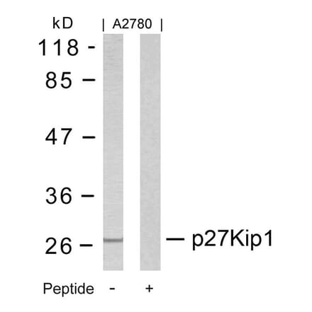 Western blot - p27Kip1 (Ab-10) Antibody from Signalway Antibody (21150) - Antibodies.com