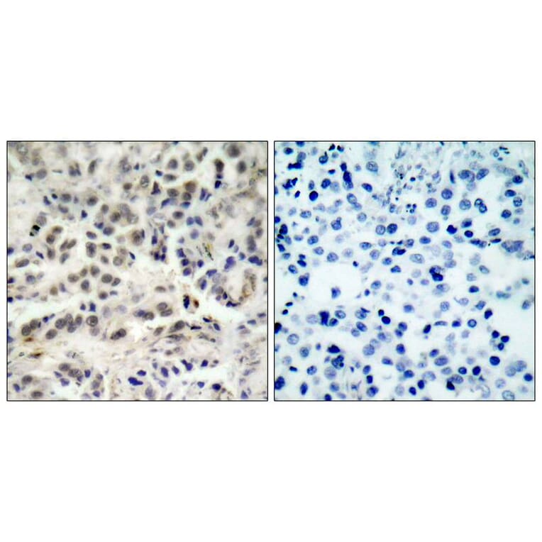Immunohistochemistry - p27Kip1 (Ab-10) Antibody from Signalway Antibody (21150) - Antibodies.com