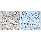 Immunohistochemistry - p27Kip1 (Ab-10) Antibody from Signalway Antibody (21150) - Antibodies.com