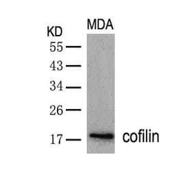 Western blot - cofilin (Ab-3) Antibody from Signalway Antibody (21164) - Antibodies.com