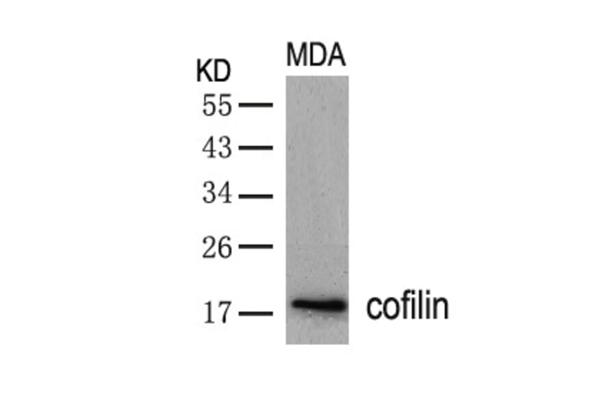 Western blot - cofilin (Ab-3) Antibody from Signalway Antibody (21164) - Antibodies.com