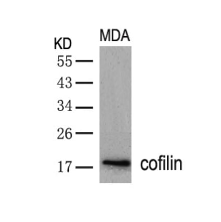 Western blot - cofilin (Ab-3) Antibody from Signalway Antibody (21164) - Antibodies.com
