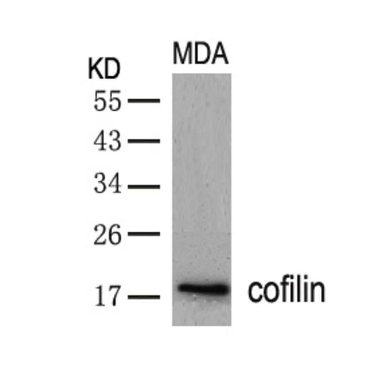Western blot - cofilin (Ab-3) Antibody from Signalway Antibody (21164) - Antibodies.com