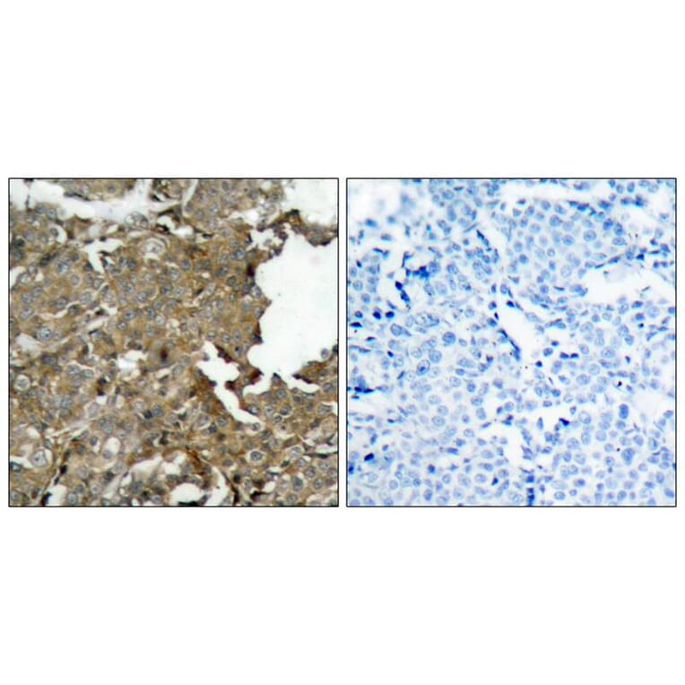 Immunohistochemistry - cofilin (Ab-3) Antibody from Signalway Antibody (21164) - Antibodies.com