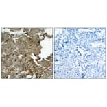 Immunohistochemistry - cofilin (Ab-3) Antibody from Signalway Antibody (21164) - Antibodies.com