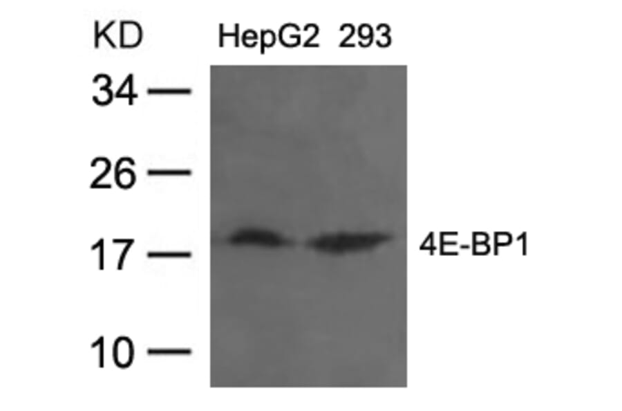 Western blot - 4E-BP1 (Ab-36) Antibody from Signalway Antibody (21215) - Antibodies.com
