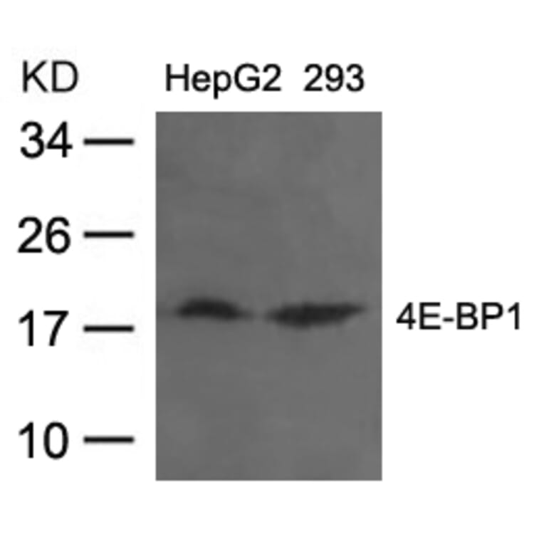 Western blot - 4E-BP1 (Ab-36) Antibody from Signalway Antibody (21215) - Antibodies.com