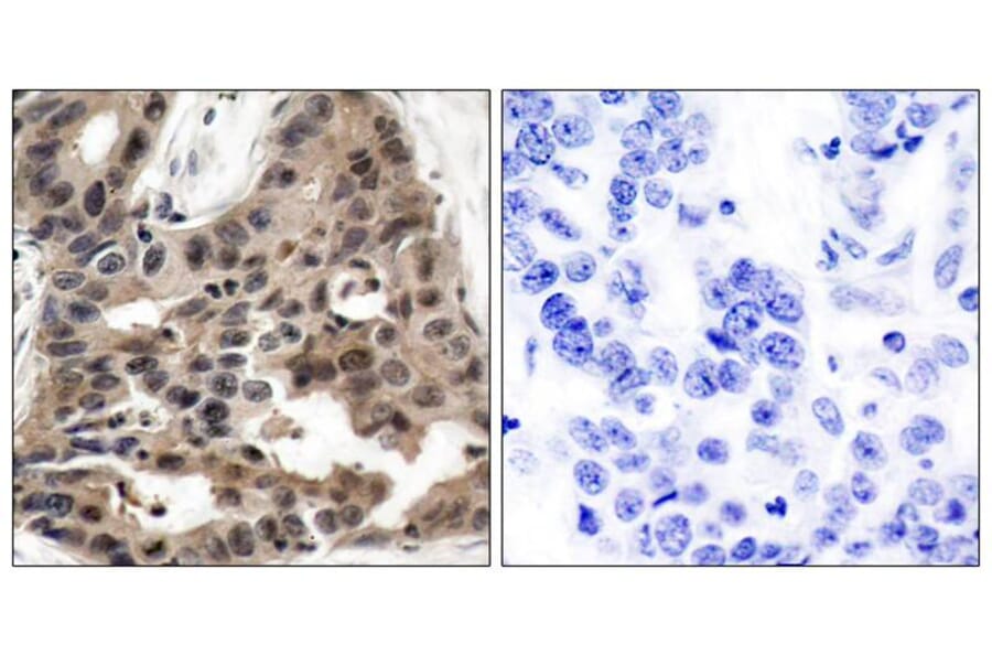 Immunohistochemistry - 4E-BP1 (Ab-36) Antibody from Signalway Antibody (21215) - Antibodies.com