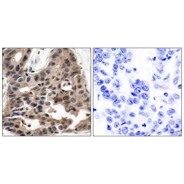 Immunohistochemistry - 4E-BP1 (Ab-36) Antibody from Signalway Antibody (21215) - Antibodies.com