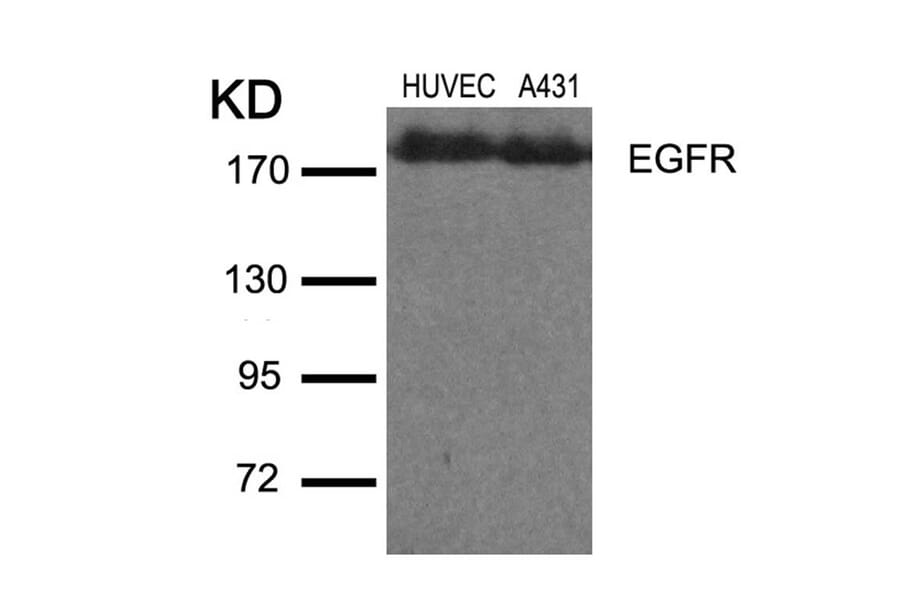 Western blot - EGFR (Ab-1110) Antibody from Signalway Antibody (21256) - Antibodies.com