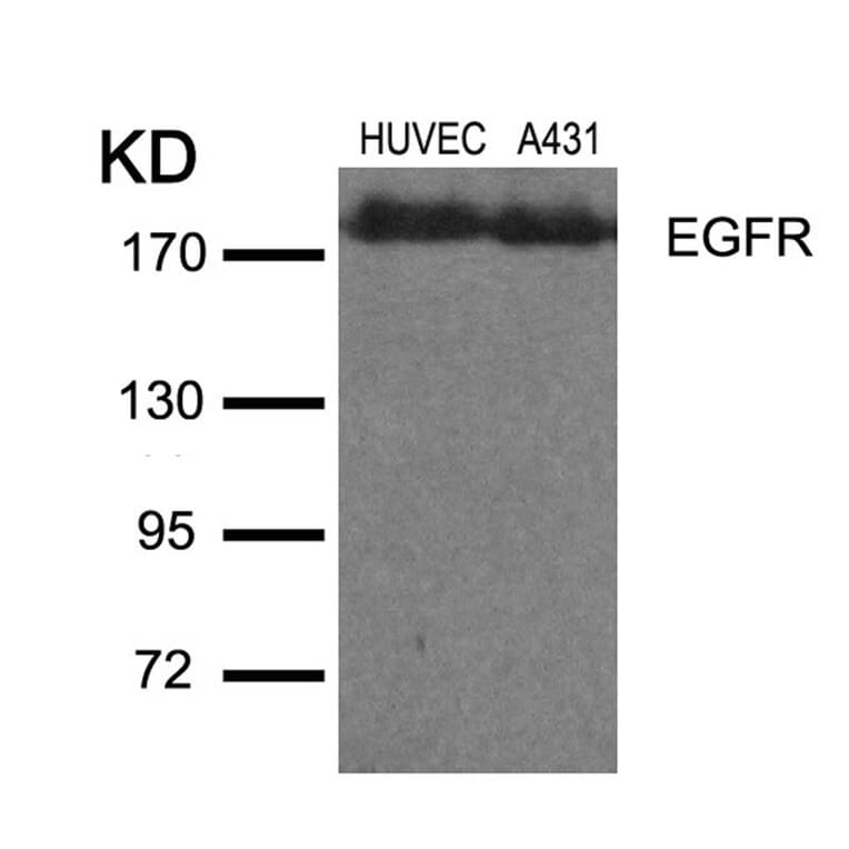 Western blot - EGFR (Ab-1110) Antibody from Signalway Antibody (21256) - Antibodies.com
