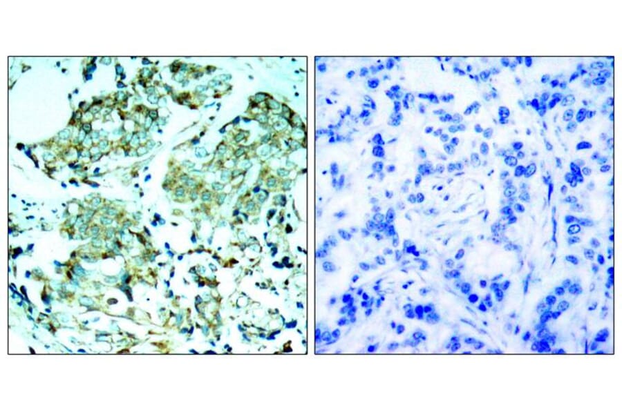 Immunohistochemistry - EGFR (Ab-1110) Antibody from Signalway Antibody (21256) - Antibodies.com