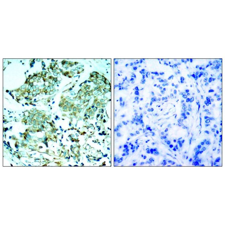 Immunohistochemistry - EGFR (Ab-1110) Antibody from Signalway Antibody (21256) - Antibodies.com