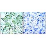 Immunohistochemistry - EGFR (Ab-1110) Antibody from Signalway Antibody (21256) - Antibodies.com