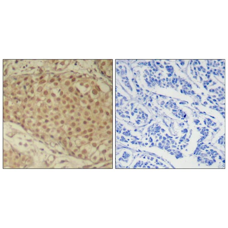 Immunohistochemistry - Smad2 (Ab-220) Antibody from Signalway Antibody (21323) - Antibodies.com